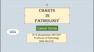 ChartCANCER CERVIX Pathology RATS MBBS SRM Dr GSS University Exam [upl. by Ahsoyem598]