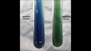 Citrate Utilization Test [upl. by Orgel]