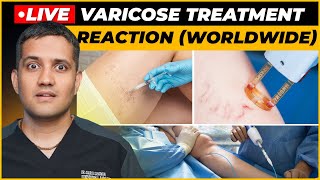 My Reaction on Venaseal Sclerotherapy amp Laser Treatment for varicose veins  Dr Gaurav G IR [upl. by Sal]