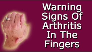 Warning Signs Of Arthritis In The Fingers [upl. by Costanza]