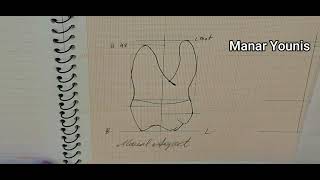 Drawing Maxillary Right first Molar Part 2 mesial distal and occlusal aspects [upl. by Siver]