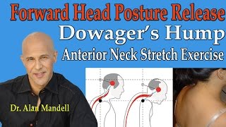 Forward Head Posture Release Dowagers Hump Anterior Neck Stretches  Dr Mandell [upl. by Dnaletak]