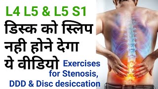 exercises for back pain Disc Dessication stenosis l4l5 l5s1 facet joint by dr sandeep Bhardwaj [upl. by Ttenaej]