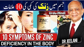 10 Symptoms of Zinc Deficiency in The Body II जिंक की कमी I جسم میں زنک کی کمی کی 10علامات drjeelani [upl. by Novia341]