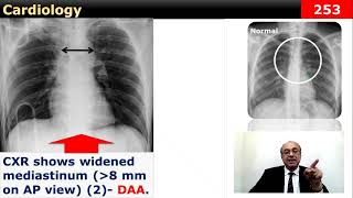 internalmedicine cme usmle محاضراتباطنة ecg كورساتباطنة clinical clinical medicine [upl. by Haeluj458]