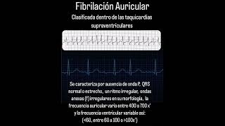 Fibrilación Auricular [upl. by Odanref]