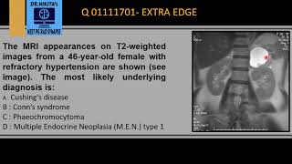 PHEOCHROMOCYTOMA MRI [upl. by Raynold606]