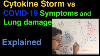 Episode001 Cytokine storm in the lungs of COVID19 patients [upl. by Alaaj944]