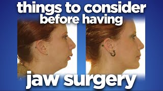 Things to consider before having jaw surgery by dr Mike Mew [upl. by Siriso]