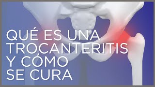 Qué es una trocanteritis y cómo se cura [upl. by Yerac154]