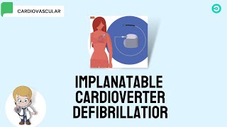 ICD Implantable Cardioverter Defibrillator [upl. by Kcirdnekal]