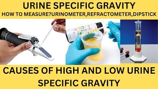 URINE SPECIFIC GRAVITYHOW TO MEASURECAUSES OF HIGH AND LOW SPECIFIC GRAVITYURINE ROUTINE [upl. by Kraus449]