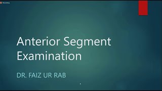 Anterior Segment Examination  Clinical  Ophthalmology [upl. by Nowd864]