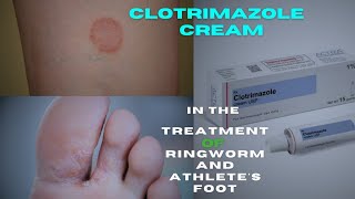 Clotrimazole cream An Effective Antifungal Cream for Ring worm  Treatment and Usage [upl. by Stern]