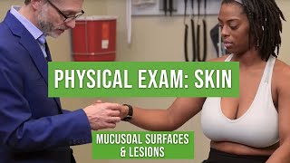 Physical Exam Of The Skin And Mucosa [upl. by Nimaj]