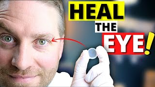 Amniotic Membrane For Dry Eye And More AMAZING Eye Healing Properties [upl. by Oswal]