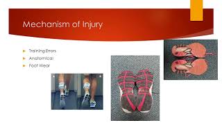 Medial Tibial Stress Syndrome [upl. by Anitsyrhk897]