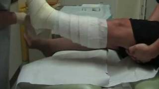 Wound Management  How to apply a single layer high compression bandage [upl. by Kcirdahs462]