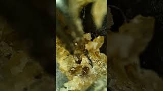 कान का मेल माइक्रोस्कोप में कैसा दिखता है ear wax under microscope shorts microscope [upl. by Eniamrehs]