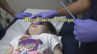 Nasal Foreign Body Removal Techniques [upl. by Einej]