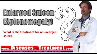 Enlarged Spleen Splenomegaly What is the treatment for an enlarged spleen [upl. by Ner]