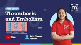 Thrombosis and Embolism with Dr Priyanka Sachdev [upl. by Wally30]