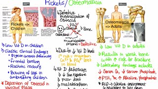 What is RicketsOsteomalacia [upl. by Avin]