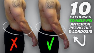 10 Exercises to Help Fix Anterior Pelvic Tilt amp Lordosis [upl. by Ain672]