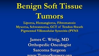 Orthopedic Oncology and Pathology Course  Benign Soft Tissue Tumors Lipoma etc  Lecture 9 [upl. by Arin]