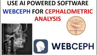 How to use Webceph for cephalometric analysis  FREE AI Tool for Dentistry [upl. by Notloc]