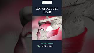 Rotator cuff tear 3D animation  Shoulder arthroscopy 3D animation shorts animatedvideo [upl. by Clinton566]