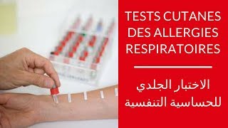 Tests cutanés des allergies respiratoires │ الاختبار الجلدي للحساسية التنفسية [upl. by Aimas]