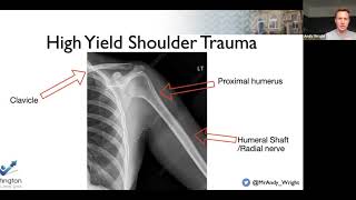 Shoulder FRCS orth revision Wrightington w BOTA [upl. by Shanta]