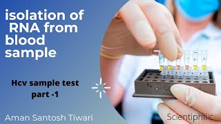 How to isolate RNA from blood plasma sample  HCV test  part  1  RNA extraction [upl. by Gemoets612]