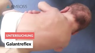 Galantreflex  Frühkindliche Reflexe  AMBOSS Video [upl. by Ronym]