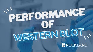 Performance of a Western Blot [upl. by Seuqram]