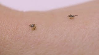 Ticks amp Lyme Disease What to know in 2024 [upl. by Elirpa]