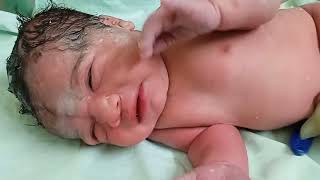 Vernix caseosa healthy baby newborn baby ShobhaNursingguide plz like plzsubscribemychannel [upl. by Erapsag]