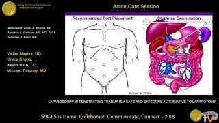 Laparoscopy in penetrating trauma is a safe amp effective alternative to laparotomy [upl. by Sylirama]