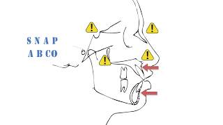 Cephalometrics Part I [upl. by Carina]