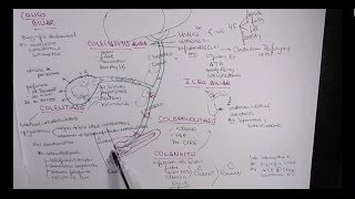 MEJOR EXPLICACIÓN COLELITIASIS COLECISTITIS COLEDOCOLITIASIS COLANGITIS [upl. by Enixam198]