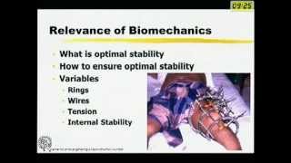 Biomechanics of Ilizarov Fixator [upl. by Nylisoj]