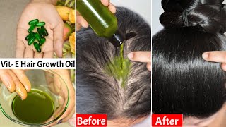 I Put👆🏼This Hair Growth Oil Daily on Hair Loss Areas amp ScalpGot Double Hair DensityThickLong Hair [upl. by Walley]