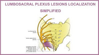 LUMBOSACRAL PLEXUS LESIONS LOCALIZATION SIMPLIFIED [upl. by Lanam]