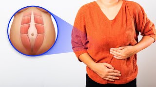 Why Is My Upper Stomach Bloated 4 Causes of Abdominal Swelling [upl. by Stearne]