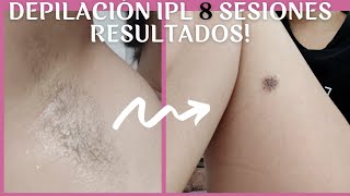 ✅ Como DEPILARSE con LUZ PULSADA IPL en CASA  FOTOS ANTES Y DESPUÉS 8 SESIONES [upl. by Ora]