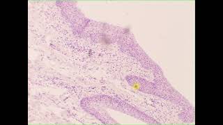 Stratified squamous epithelium non keratinized Vagina [upl. by Etessil118]