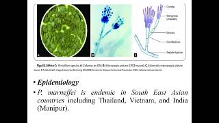 Penicillosis I Opportunistic infections I Mycotoxicosis I Medical mycosis I Medical microbiology [upl. by Catharine]