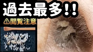 【耳掃除】44 耳かき 〜最初から最後まで取れ高あり過ぎ〜 earwax [upl. by Garvin]