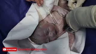 Special newborn baby with high weight the moment after delivery viral baby cute [upl. by Yanehs905]